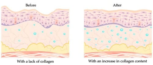 Collagen