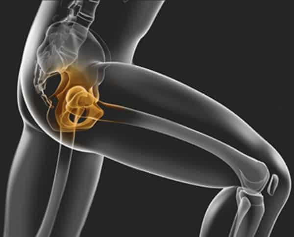 Hip joint