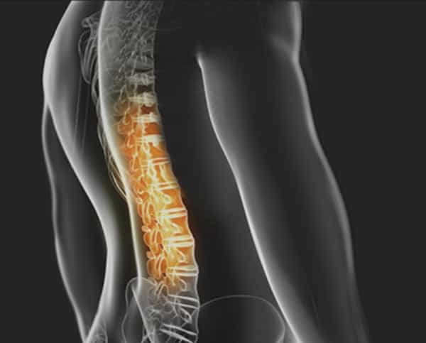 Spinal joints